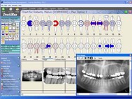 DentiMax Dental Software screenshot